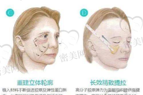 芦红丹医生荣誉资质：
