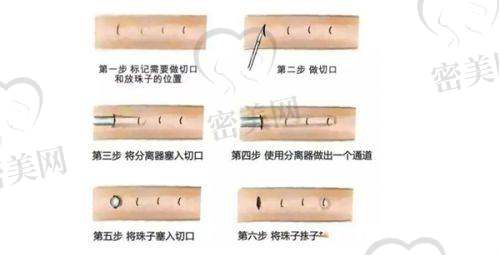 南阳天后医疗美容门诊部怎么预约挂号？