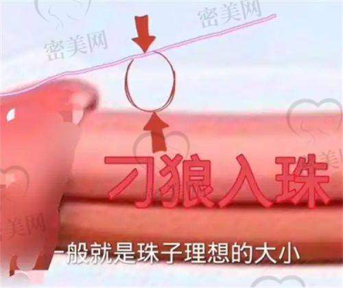 嘉善县第一人民医院整形外科特色项目：