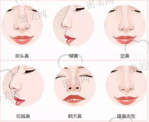 平顶山新华花熙医疗美容诊所特色项目: