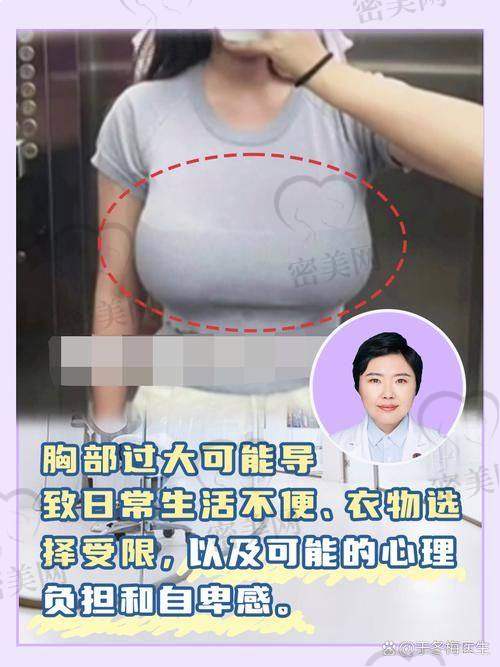 重庆缩胸手术三等甲整形医院推荐及基本信息一览
