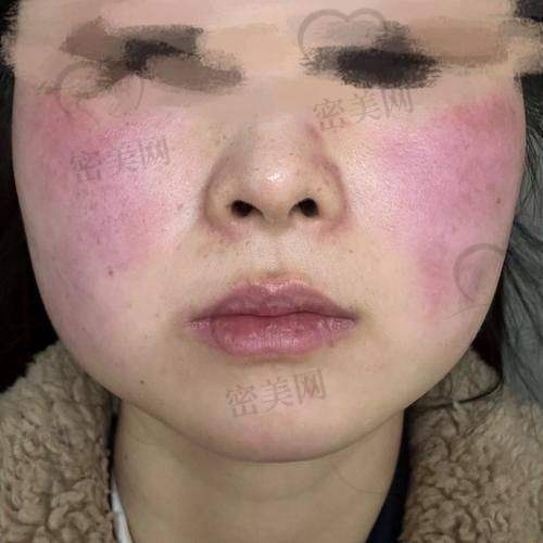 手术过程：紧张又期待