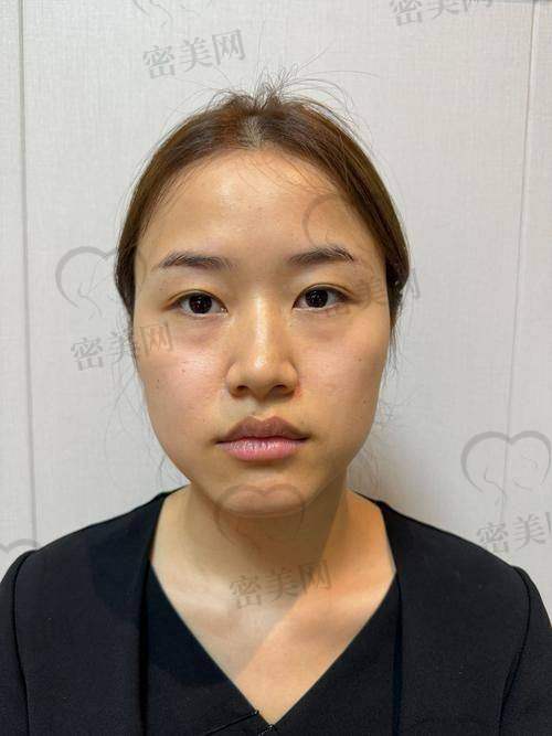 不同填充方式的副作用