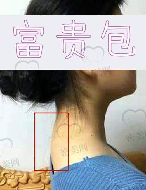 治疗过程体验：轻松又有效