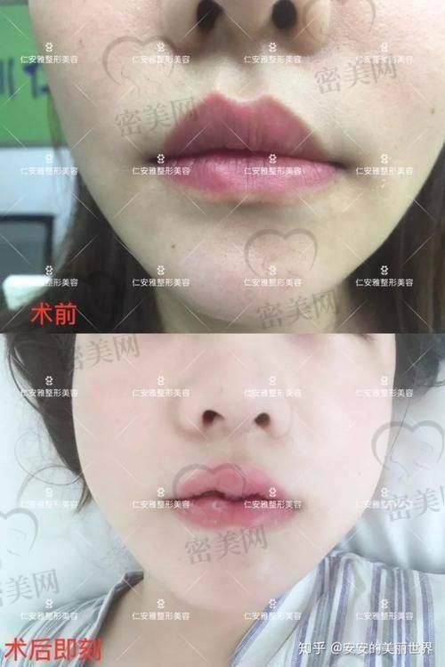 从脸型角度看，哪种唇型更衬你？