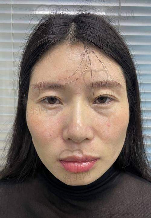 不同填充方式的费用情况