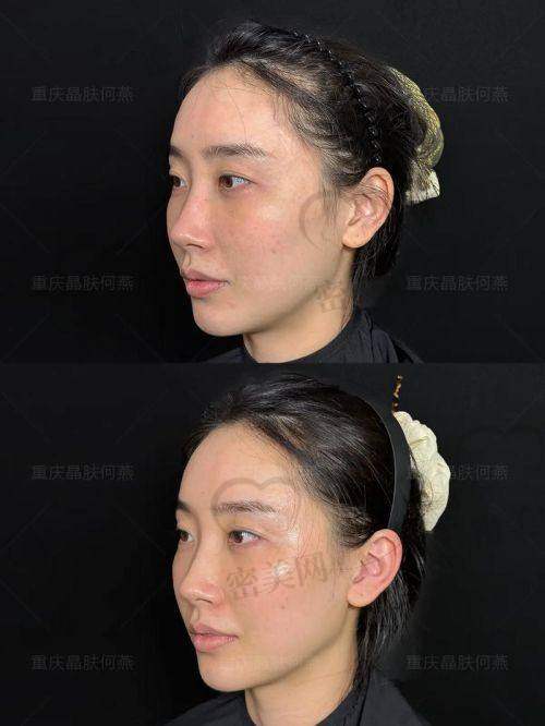 修复阶段：一天比一天美，惊喜不断