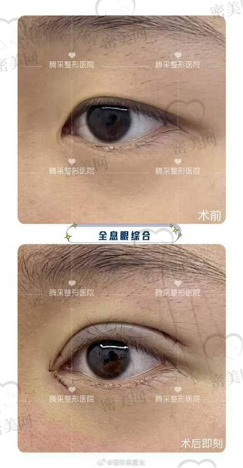 李伟医生技术特点：