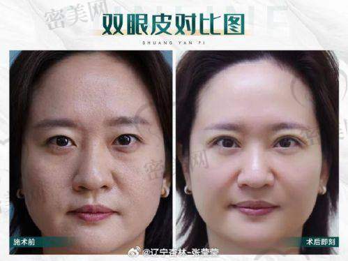 杨军飞医生口碑怎么样？