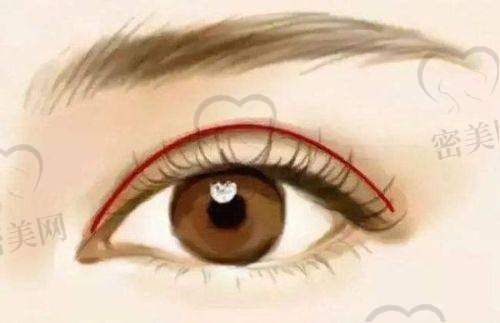 普通人如何避免踩雷？选择类似成都素美这样的医院要看4件事