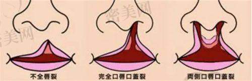 温馨贴士：首次到北京华韩就诊需注意这些