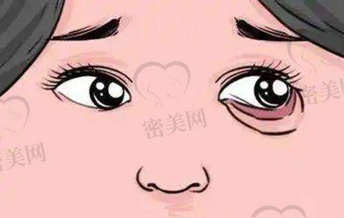 北京画美医生马群——鼻整形专精户