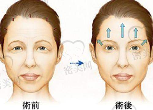 【方千子医生擅长项目】