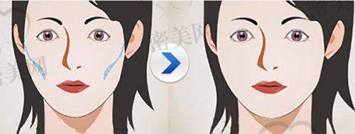台州爱莱美整形门诊部：新晋机构，设备新，价格美丽