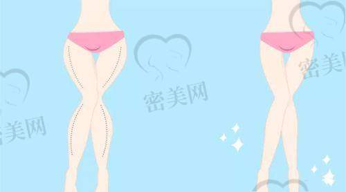 综合评估:如果你在长春找一家靠谱医美医院,中妍值得列入优选
