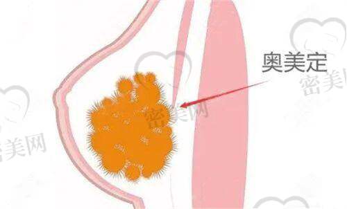 西安张永医生:真实术后实例,照片对比更有说服力