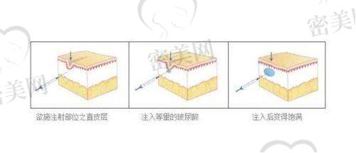 【赵美红医生口碑怎么样？】