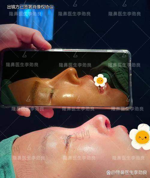 重庆华美紫馨整形医院张平：美鼻技艺不错的魔法师