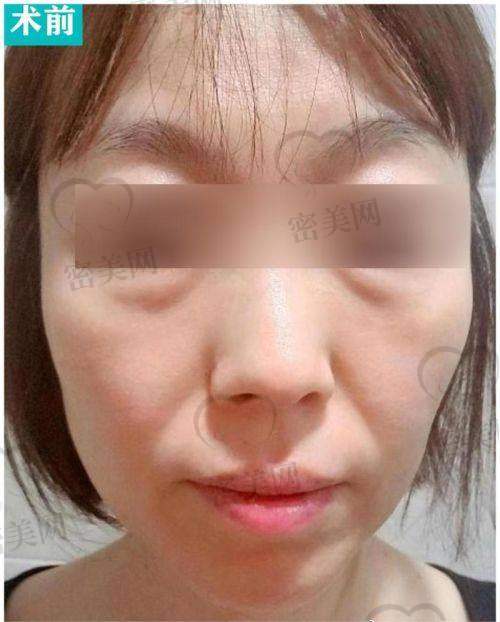 陈兵医生技术特点