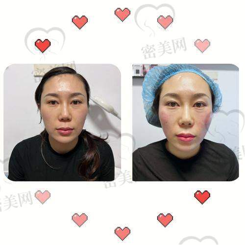 重庆华美紫馨整形医院张平微拉美：开启你的青春之旅