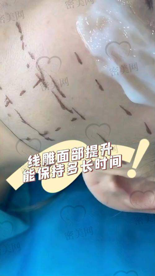 重庆华美紫馨整形医院张平医生：技术不错的变得更美魔法师