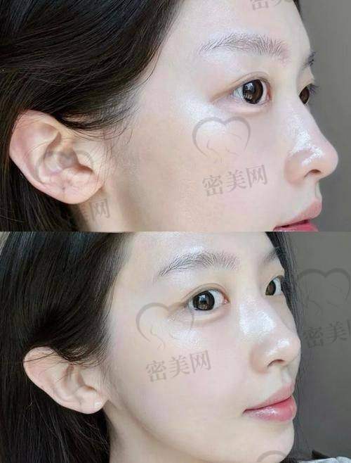 患者眼中的王洪：“比变得更美更重要的，是修复我的自信”