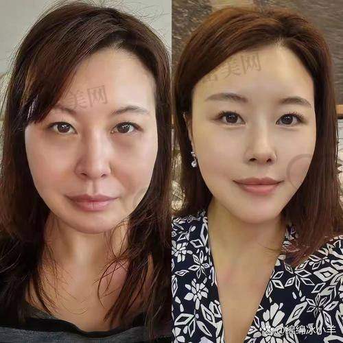 见证奇迹，从“馒人”到精致美人的逆袭