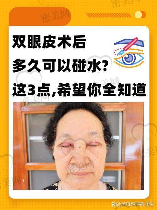 重庆华美紫馨整形医院刘天云美眼小绷带8800起，重塑灵动双眸，开启眼部年轻化奇迹！