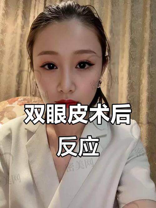 重庆华美紫馨整形医院刘天云美眼小绷带：口碑爆棚