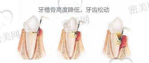 惠州惠阳丽港丽格医疗美容门诊部是正规的吗？