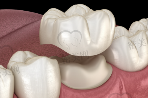 【石家庄高邑献恩口腔诊所特色项目:】