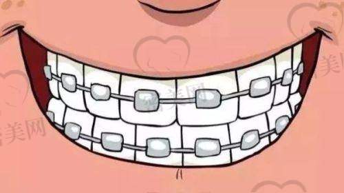 【秦皇岛博善口腔海阳路诊所怎么预约挂号?】