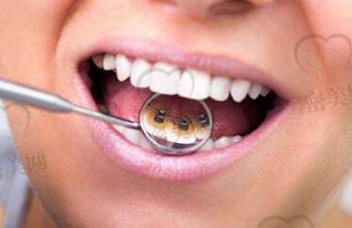 【衡水景县博康口腔门诊部特色项目:】