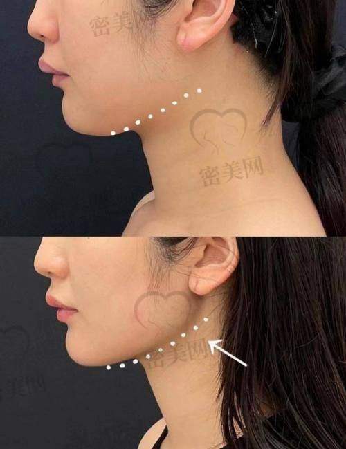 陈小平医生擅长项目: