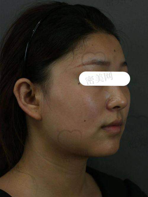 陈小平医生技术特点: