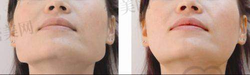 陈小平医生怎么预约挂号?