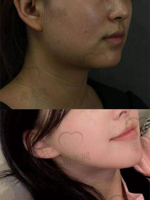 陈小平医生口碑怎么样?