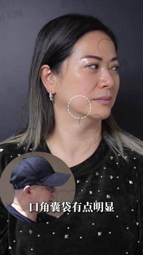 重庆华美紫馨整形医院：眉眼小拉皮的专精殿堂