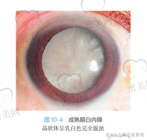 还有人忧虑：手术安不安心？需不需要住院？