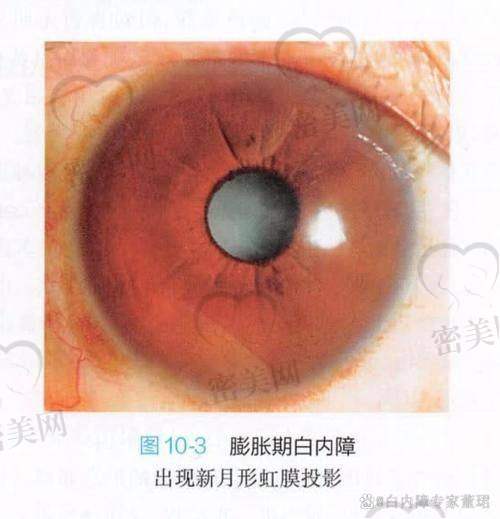 看懂都不难！申请手术只要六步操作