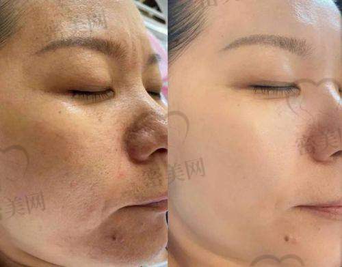 看成效:一次就能看结果?要几次才值得打卡?