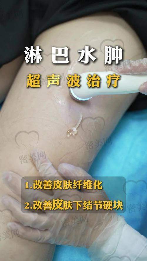 小提醒:术后护理真的不能忽视