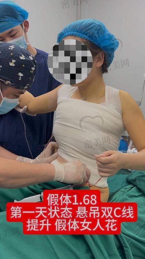 重庆华美紫馨整形医院张平曼托假体隆胸：技术优势大揭秘