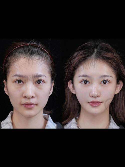 重庆华美紫馨张平：真人实例见证奇迹