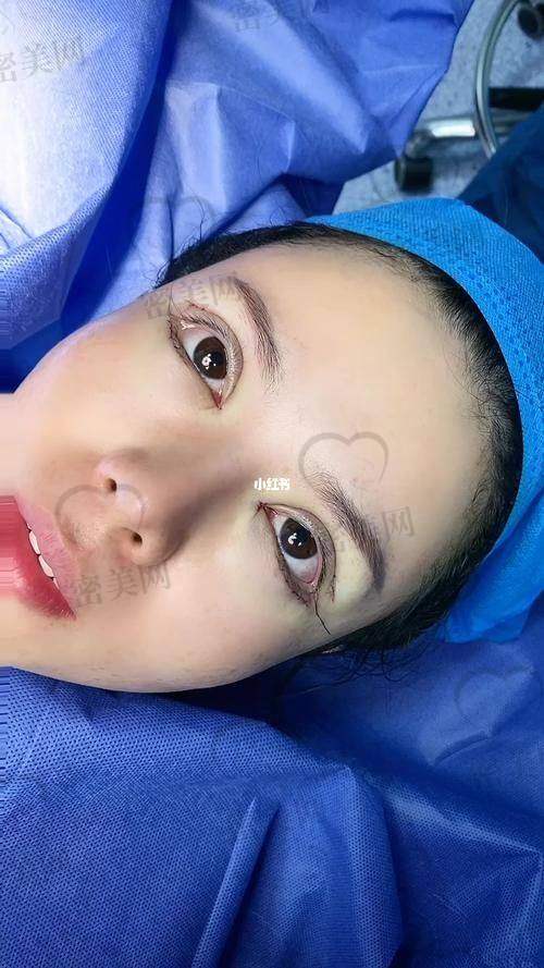 张克医生怎么预约挂号？