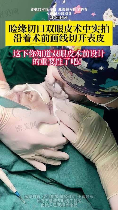 心动不如行动：7000 元起双眼皮等你来体验