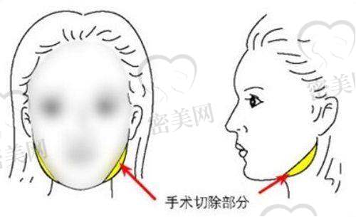 北京中 医 药大学东方医院整形美容科特色项目：