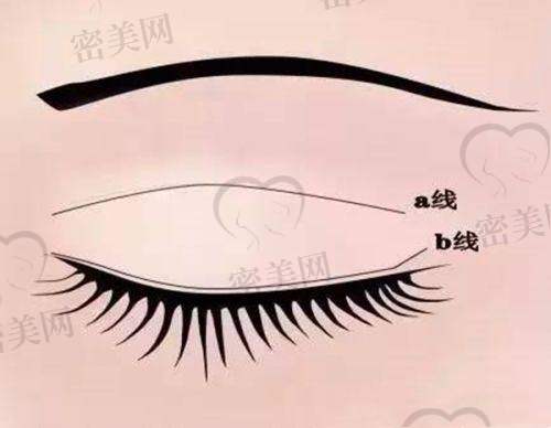 保定悦美医疗美容门诊部