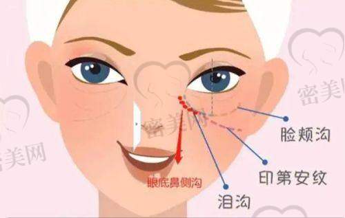 东莞米兰柏羽整形：鼻修复整形的高手医院