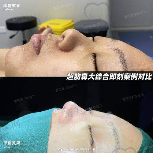 韦小勇医生口碑怎么样？